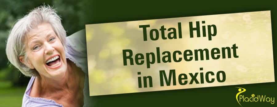 Total Hip Replacement in Mexico Patient Testimonial